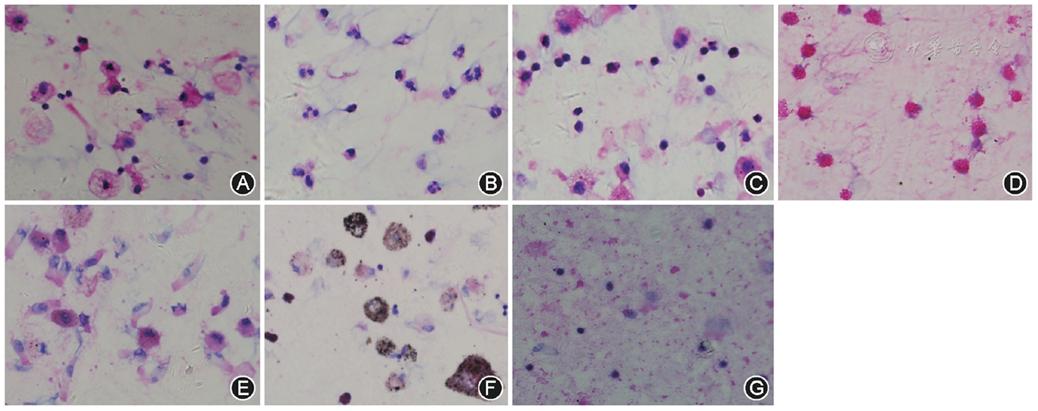 icu患者肺栓塞应急预案演练脚本,肺泡灌洗液标本标准