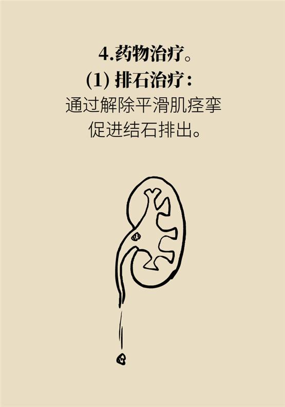 结石发作吃什么能缓解,结石每天都痛怎么办