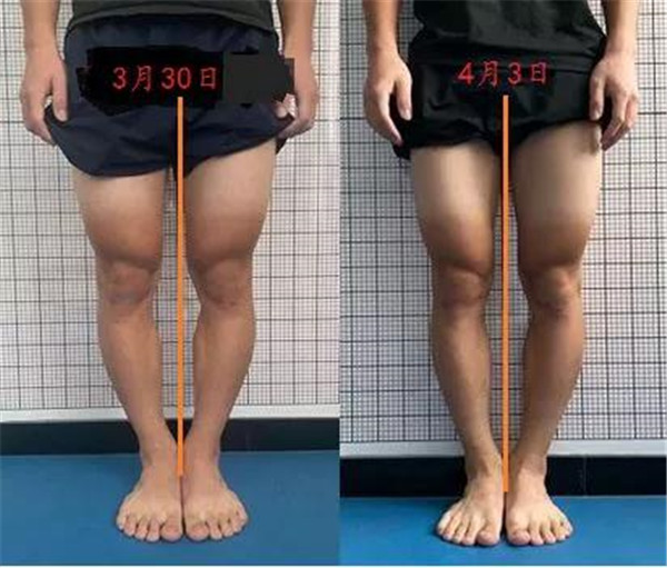 康复中心堪比“健身房”，中山这家医院可开“运动处方”