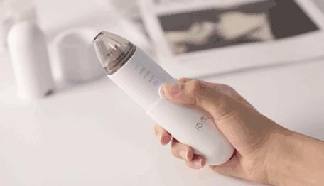 痘痘挤出的白米粒是什么,痘痘挤出来的白色乳浆是什么