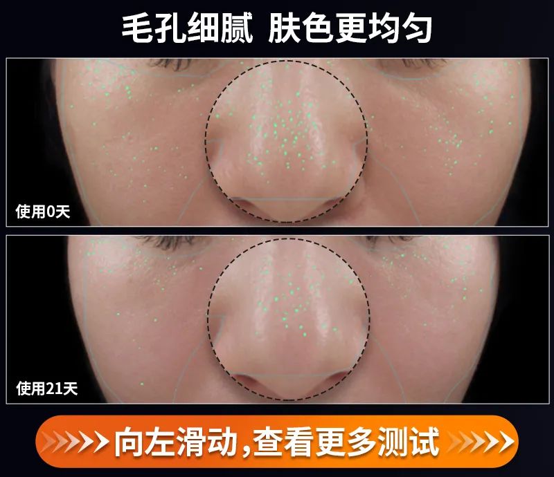 射频美容仪到底怎样,射频美容仪合格吗