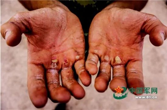 兵哥哥最新套路,兵哥哥优良作风