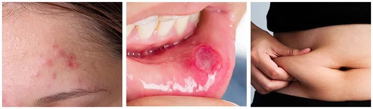 澎湃好物|嘴馋想吃烧烤炸鸡，这样做滴油不放，吃不胖，格外香