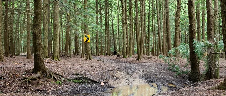 珠江妇幼子宫疤痕憩室,子宫疤痕憩室怎么改善经期长