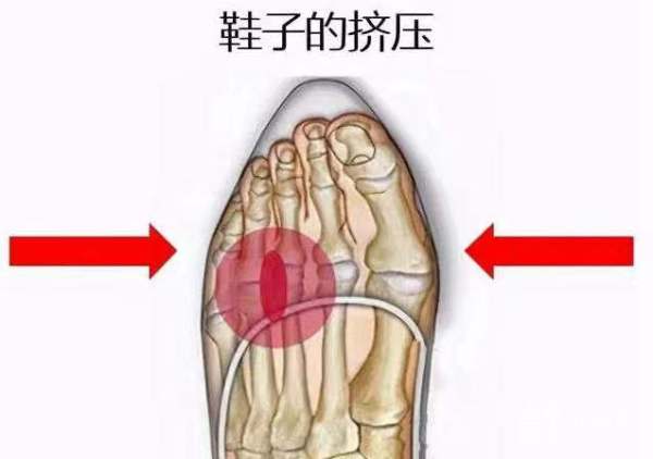 爱穿尖头鞋的女性,爱穿尖头鞋的女人个性