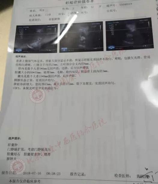 45岁女血小板偏高357要怎么降下来,35岁女性血小板452用不用治疗