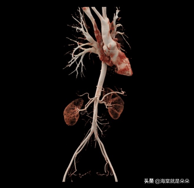 先天漏斗胸跟心脏不好有关吗,成年人漏斗胸压迫心脏