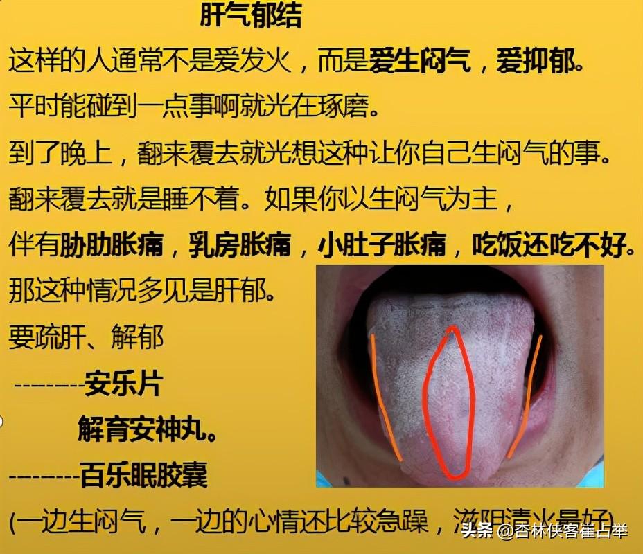 治疗失眠的十种中成药,治疗失眠多梦的中成药大全