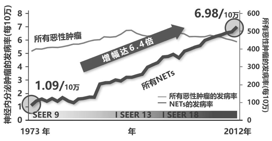 胰腺神经内分泌瘤是什么意思,胰腺神经内分泌瘤的典型ct表现