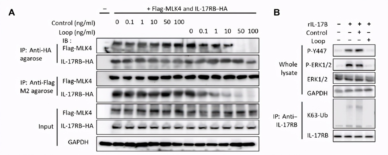 胰腺癌神经阻断术效果好吗,胰腺癌神经阻断术能持续多久有效
