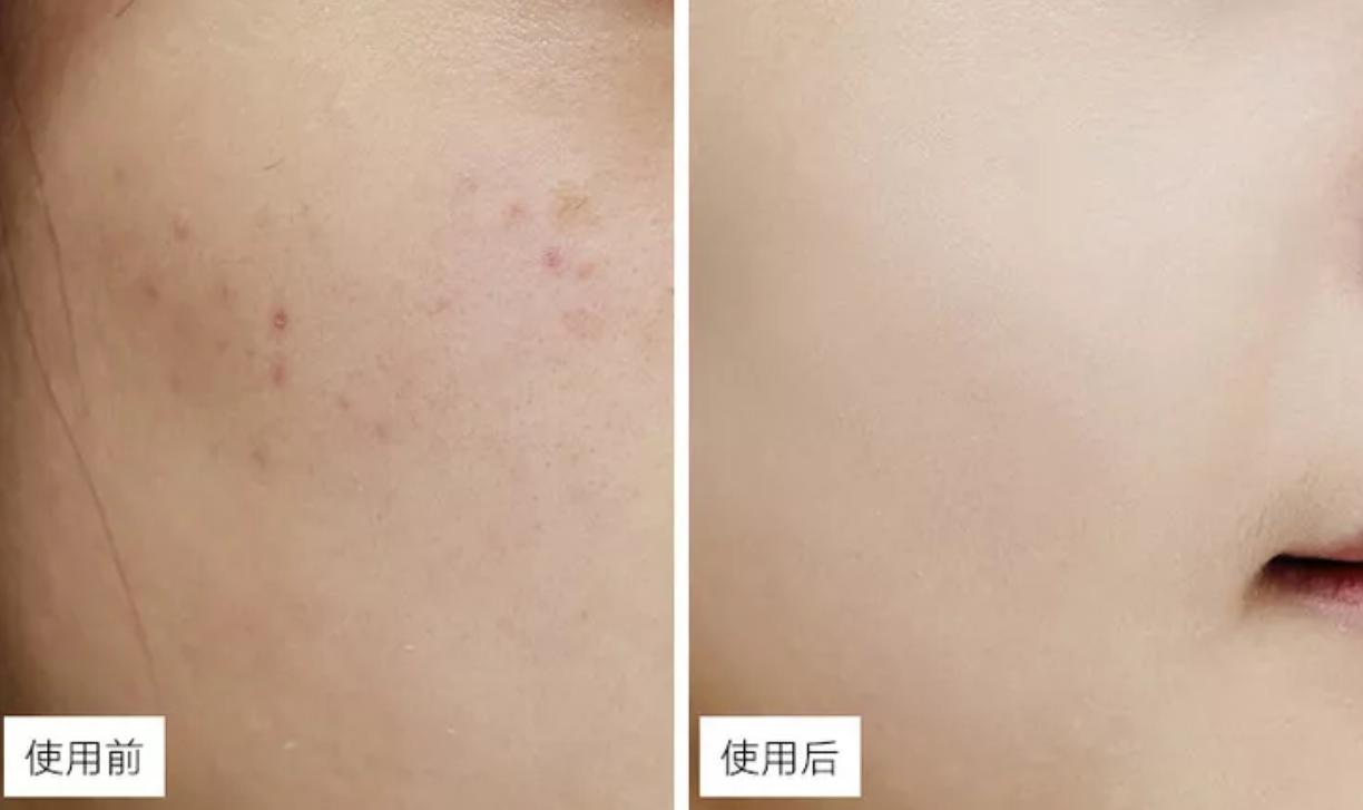 炎夏肌美白，艾喏莎珍珠膏给你健康沁养肌肤