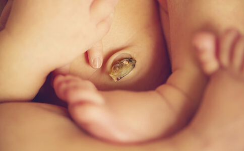 新生儿脐带有点出血怎么处理,新生儿脐带有点出血在家怎么处理