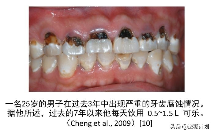 真正适合糖尿病人的饮料,糖尿病人的无糖饮料有哪些