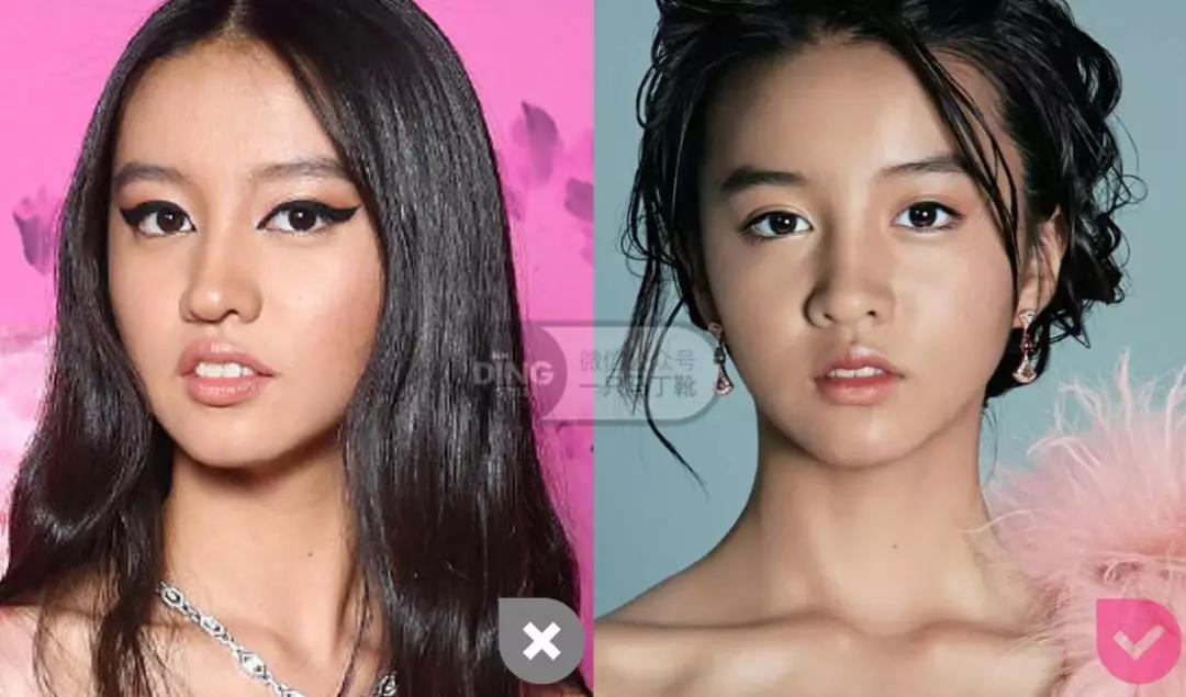 戴牙套凸嘴怎么化妆,凸嘴整牙削骨吗