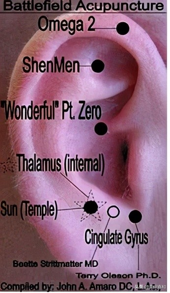 针灸为癌症人员止痛,董氏针灸治疗癌症效果好吗