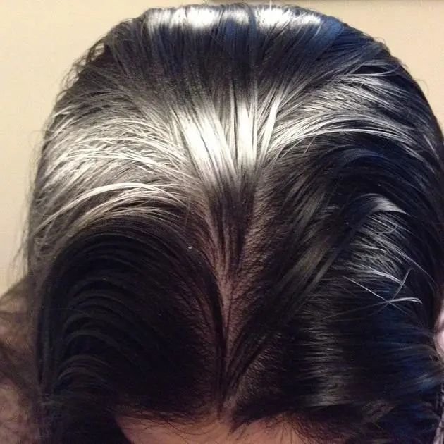 叹头部SPA！拒做人间“油”物，解锁防秃养发小妙招