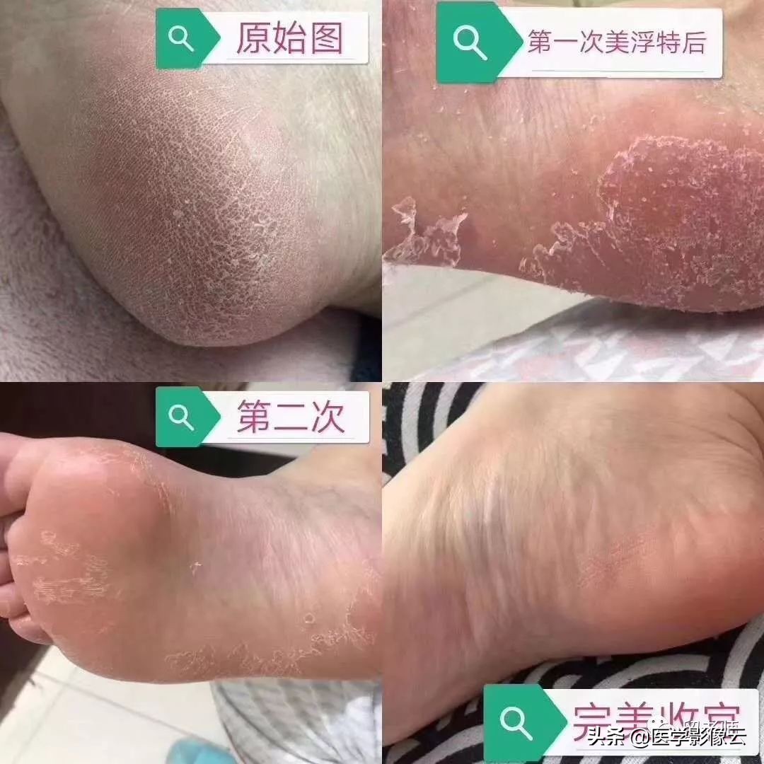 这是一条有味道的推送—jio气复发肿么办?