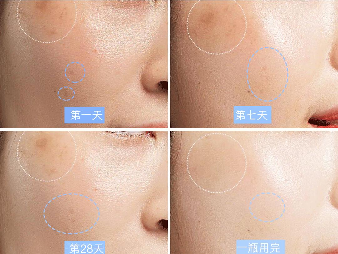 美白精华哪个变白效果最好,什么美白精华既平价又可以美白