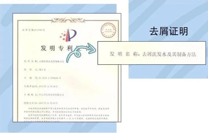 天天散着头发容易脱发吗,头发油了特别容易脱发