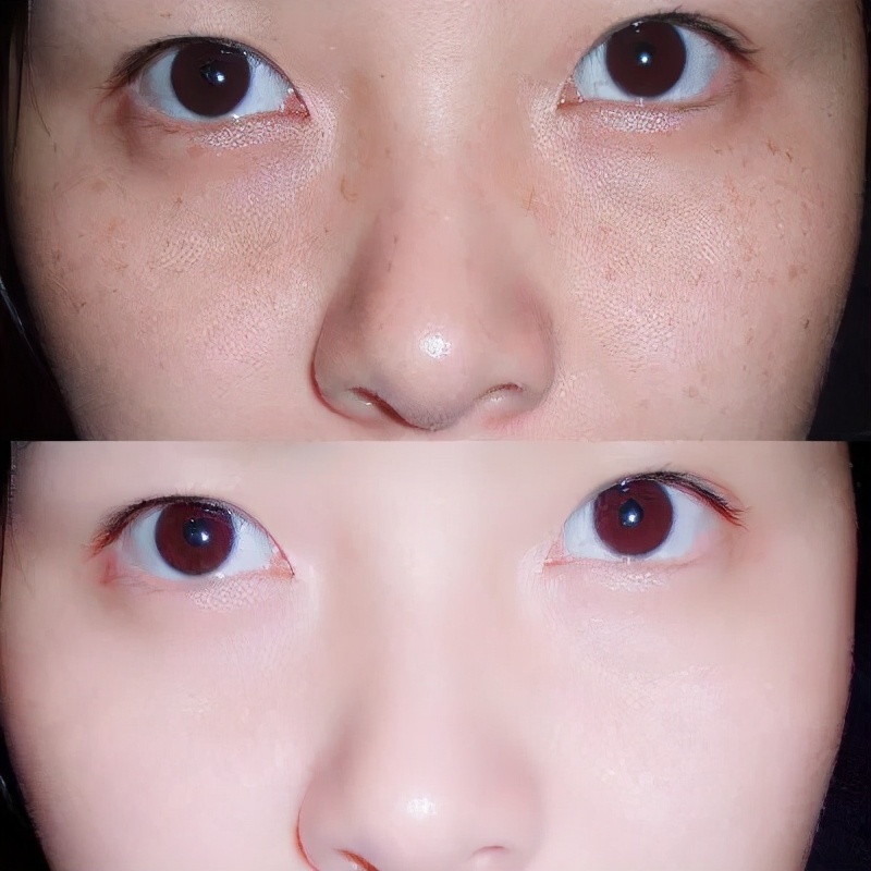 润泉贝儿祛斑产品怎么样,润泉贝儿美白祛斑套