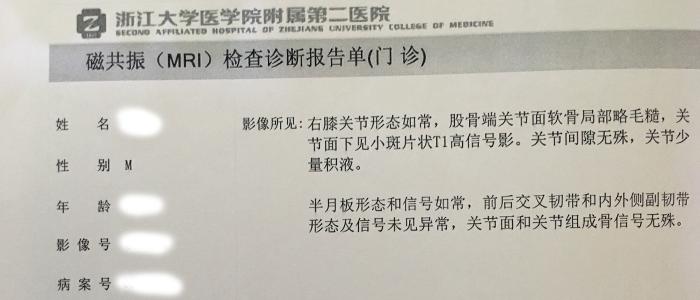 膝盖积液软骨损伤如何恢复,膝盖软骨磨损有积液