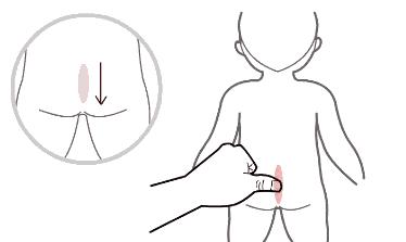 5岁多小孩便秘,5岁小孩便秘