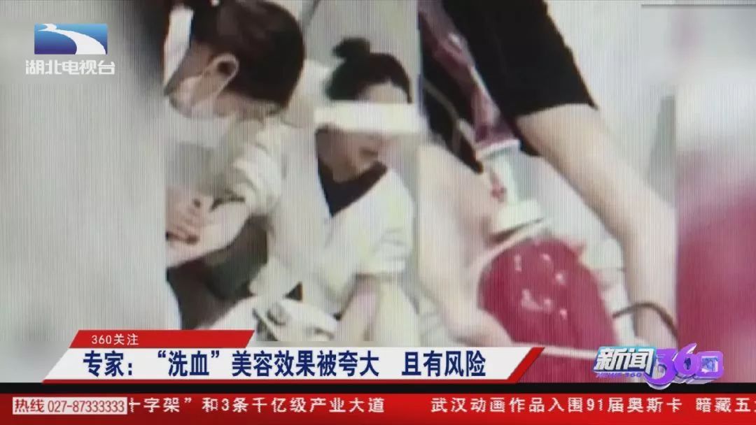 网红花5万赴日本洗血：这些自杀式美容法，正在收割你的智商税