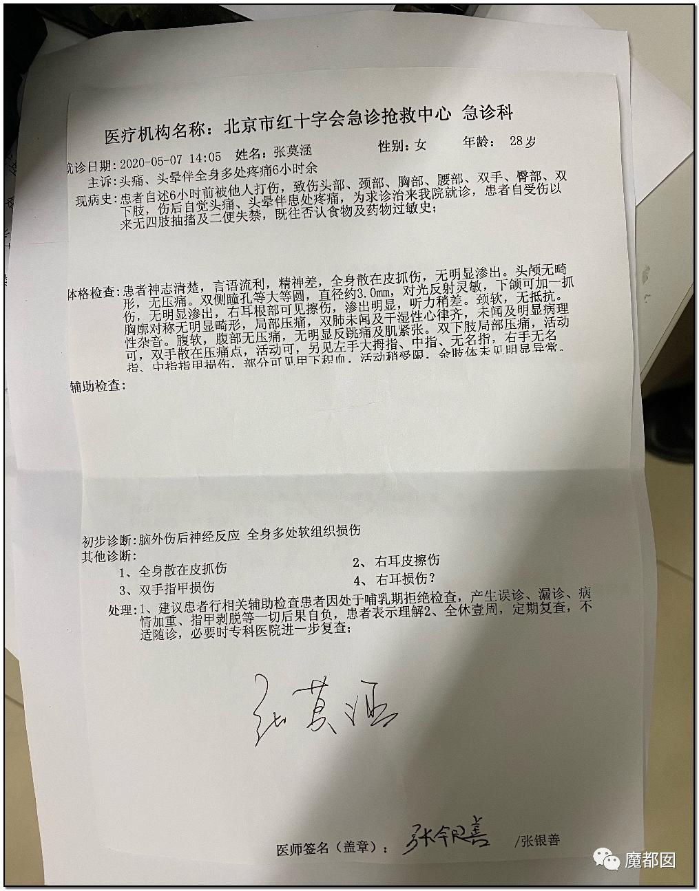 短跑名将张培萌家暴事件,短跑名将张培萌殴打岳母视频