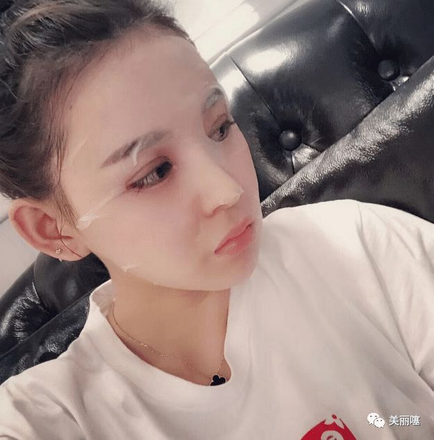 公认0差评的洗面奶,李佳琦:我用3年了,网友:仅7次黑头没了