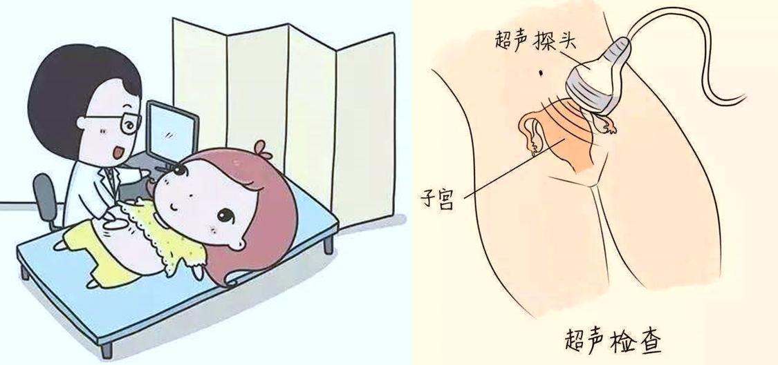 入职体检128的套餐主要体检哪些,28岁已婚女性体检套餐该怎么选择