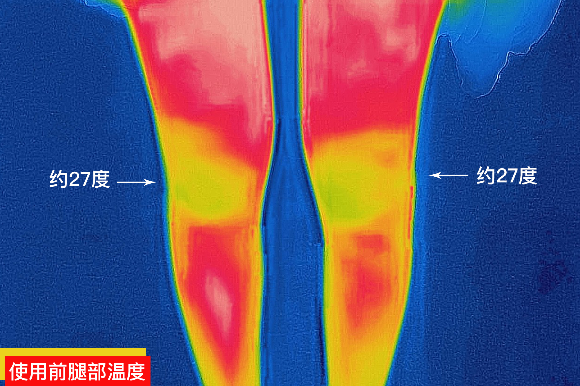 拯救关节,保暖护膝老寒腿的福音