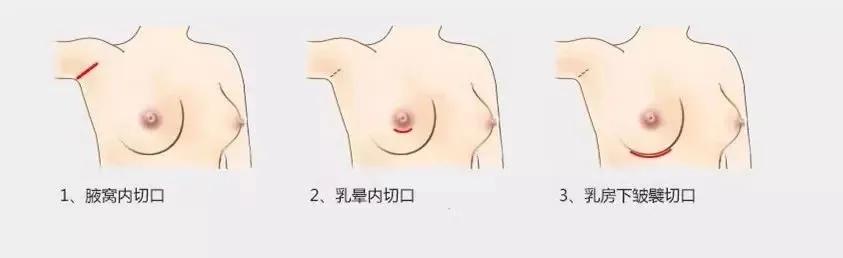 女生运动瘦不下来,女人运动瘦不下来怎么回事