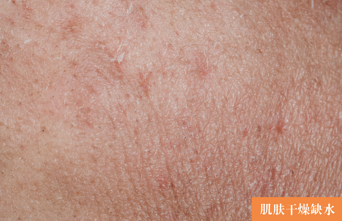 护肤重要步骤：根据这三步挑精华，皮肤再差都有救