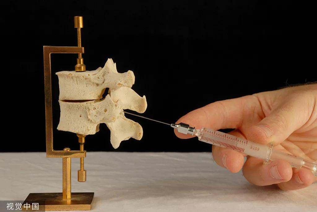 分娩阵痛穿破硬膜怎么处理,围手术期镇痛的常见问题有哪些