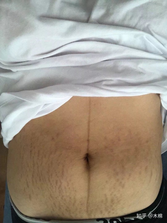 汤唯现在生了孩子吗,汤唯生了几胎