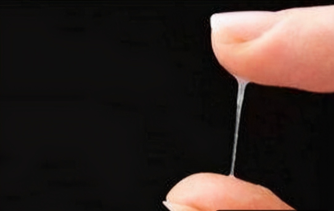 妇科炎症白带像浆糊怎么治疗,白带妇科炎症的晴雨表