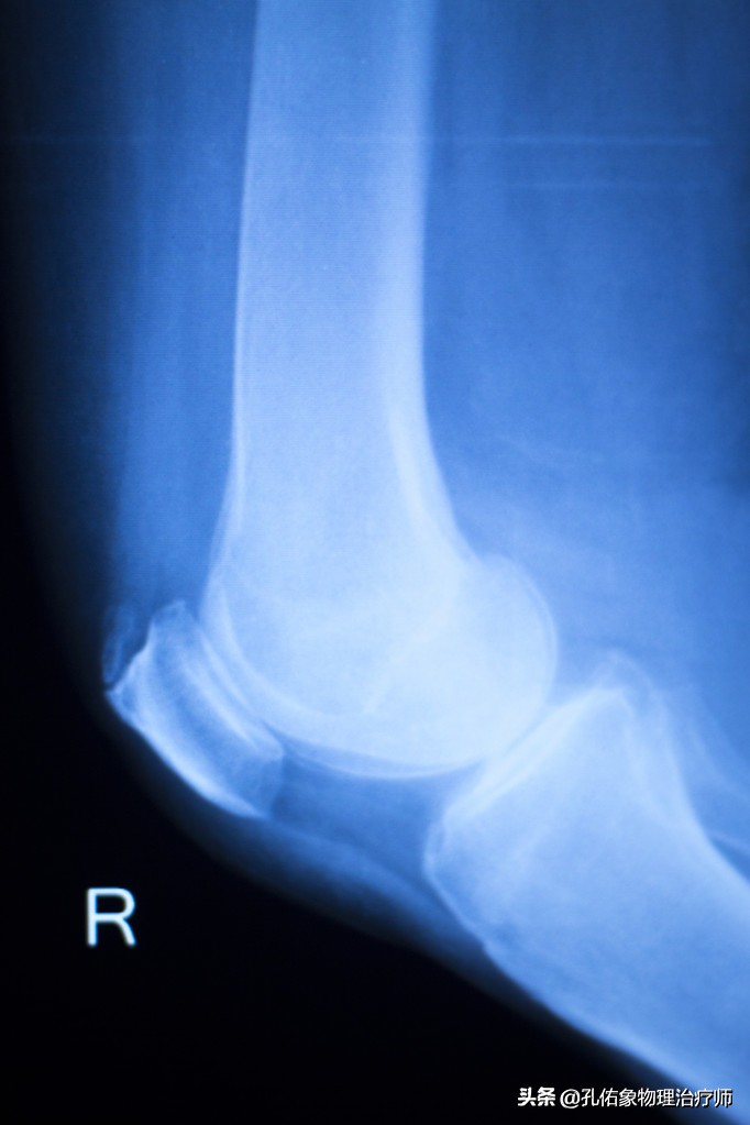 膝关节痛骨性关节炎的治疗方法,膝骨性关节炎的手法治疗视频