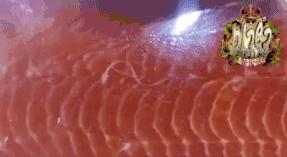 深圳2兄妹身上频现“离奇淤青”，医生：可能是吃出来的！咋回事？