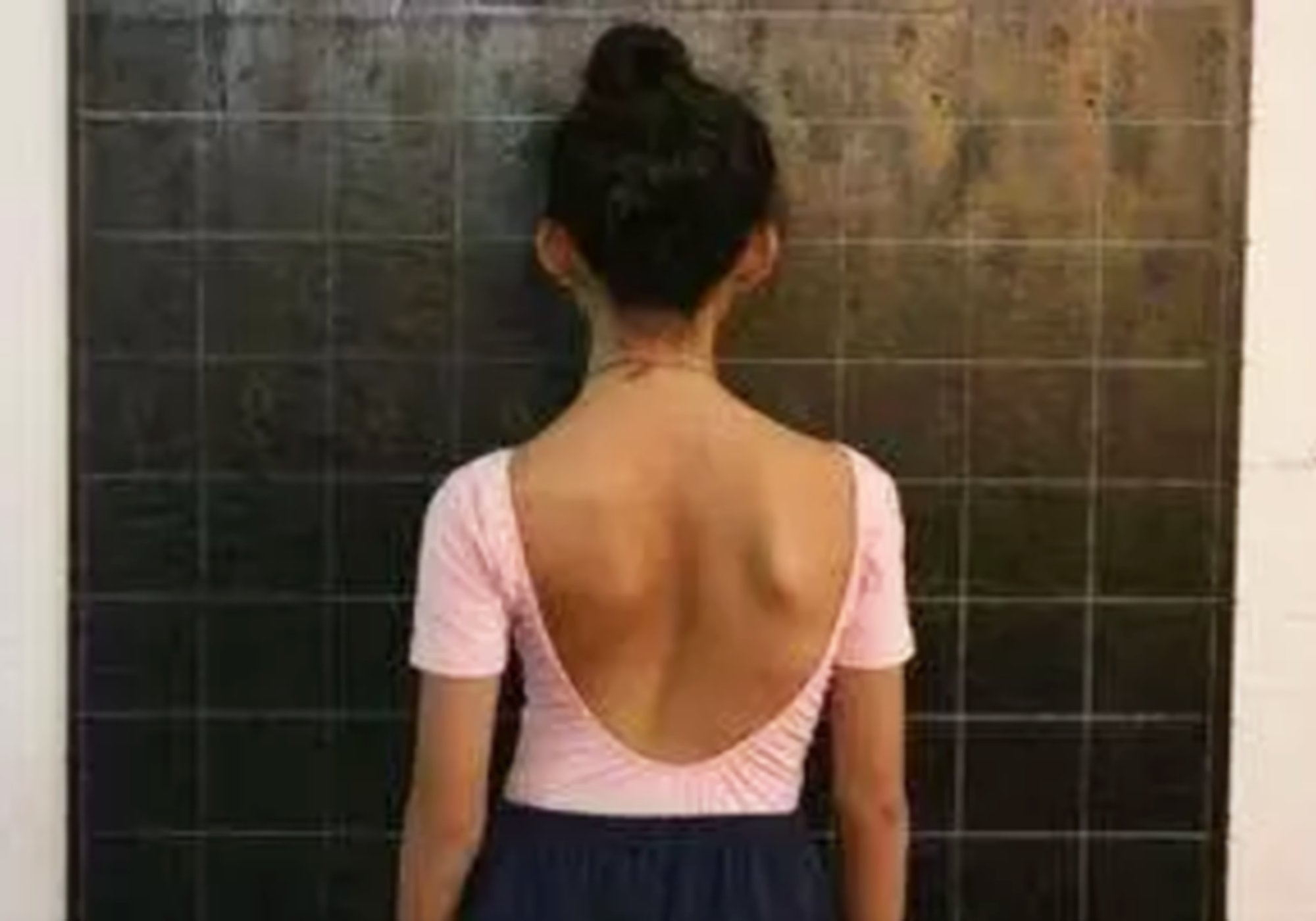 宝宝脖子轻微歪能治好么,宝宝脖子歪了是什么原因