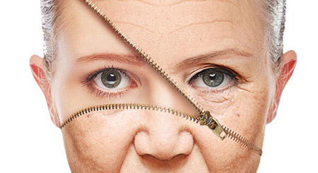 做小拉皮术后怎么保养,做拉皮手术的亲身经历注意事项