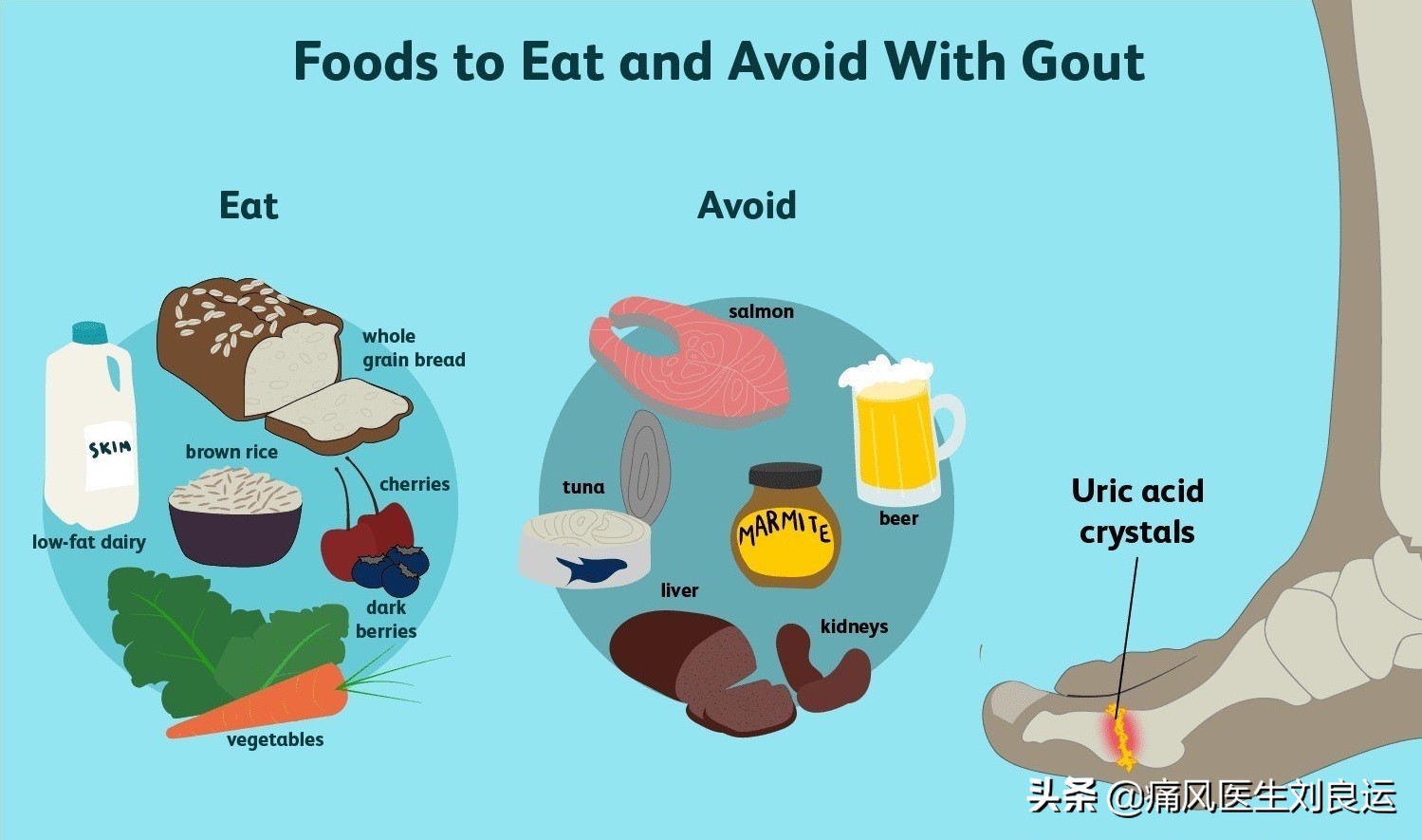 人到中年尿酸高六个生活管理要点,四十岁男人如何预防尿酸高