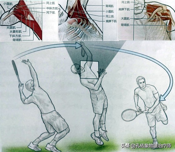 肩周炎肩膀疼是什么原因造成,肩周炎导致的肩膀疼痛怎么缓解