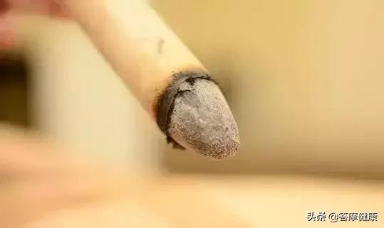 失眠严重睡不着休息最好方式,长期失眠身体无力看什么