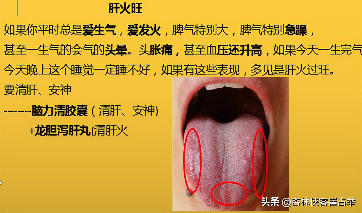 治疗失眠什么中成药效果好,治疗失眠中成药大总结