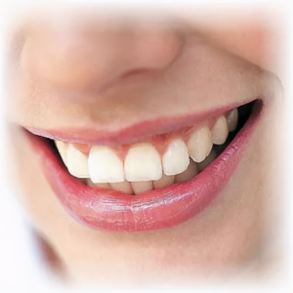 牙贴真的能美白牙齿吗,想要牙齿美白