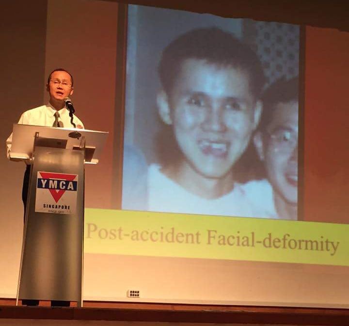 运动员车祸后失一半大脑忘记说话技能，现一口英语流利获教师学位