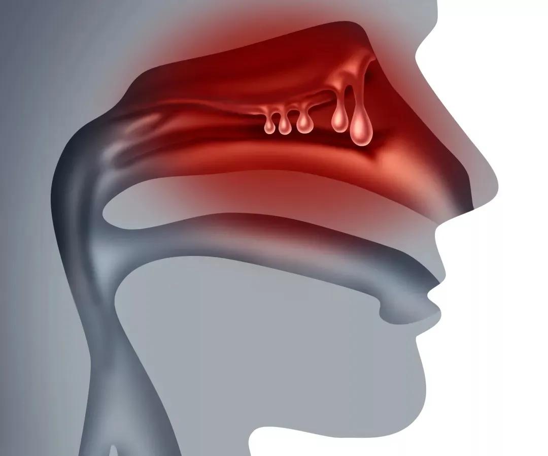 息肉时间长了会是癌吗,胃里0.2-0.4厘米的息肉要不要切
