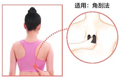 按哪个穴位容易闭经,治闭经妇科医生怎么说