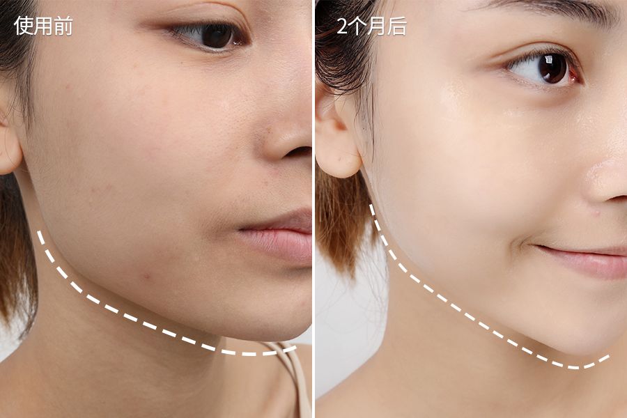 琚佸濮楁帹鑽愯憽钀勭苯鎶よ偆,琚佸濮楄憽钀勭苯绮惧崕