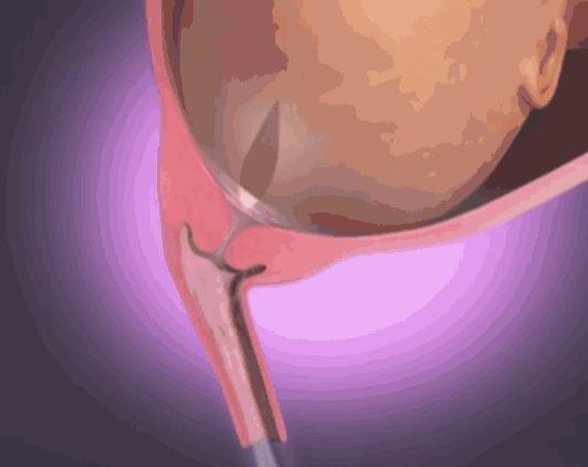 生宝宝到底有多疼看完这个就知道,生孩子到底有多疼让爸爸告诉你